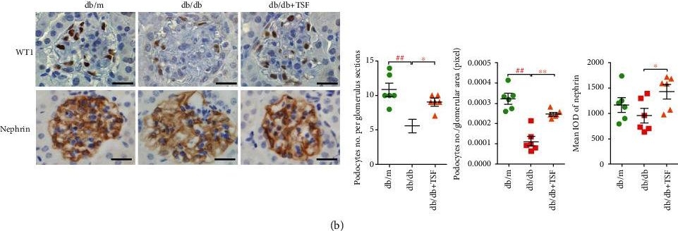 Protective Role of Tangshen Formula on the Progression of Renal Damage in db/db Mice by TRPC6/Talin1 Pathway in Podocytes.