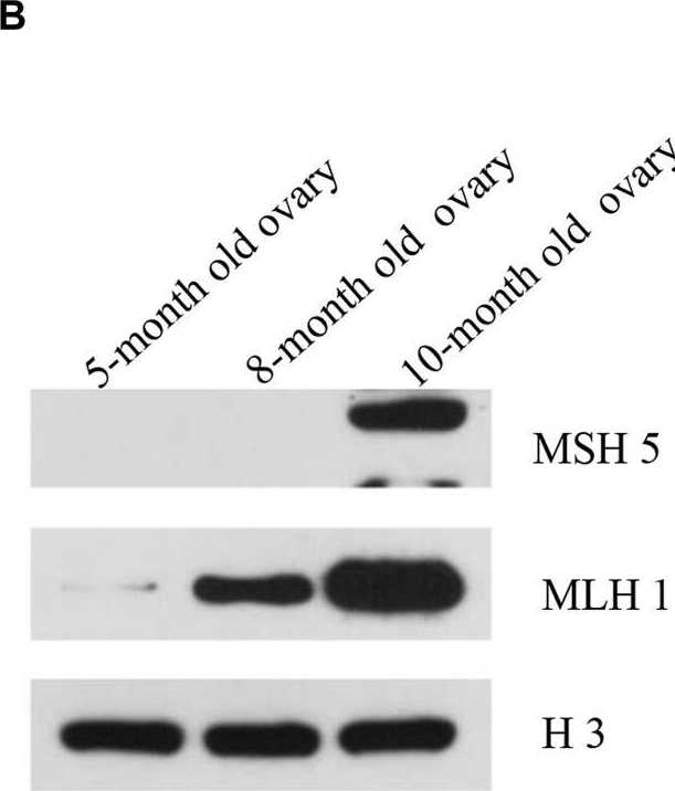 Fig.6.B showing Western Blotting from the publication: Formation of the synaptonemal complex in a gynogenetic allodiploid hybrid fish.