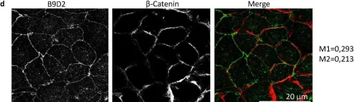 Fig.2.D showing Immunohistochemistry-immunofluorescence from the publication: New functions of B9D2 in tight junctions and epithelial polarity.