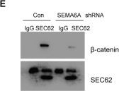 Fig.6.E showing Western Blotting in a Homo sapiens (Human) sample from the publication: VHL-HIF-2α axis-induced SEMA6A upregulation stabilized β-catenin to drive clear cell renal cell carcinoma progression.