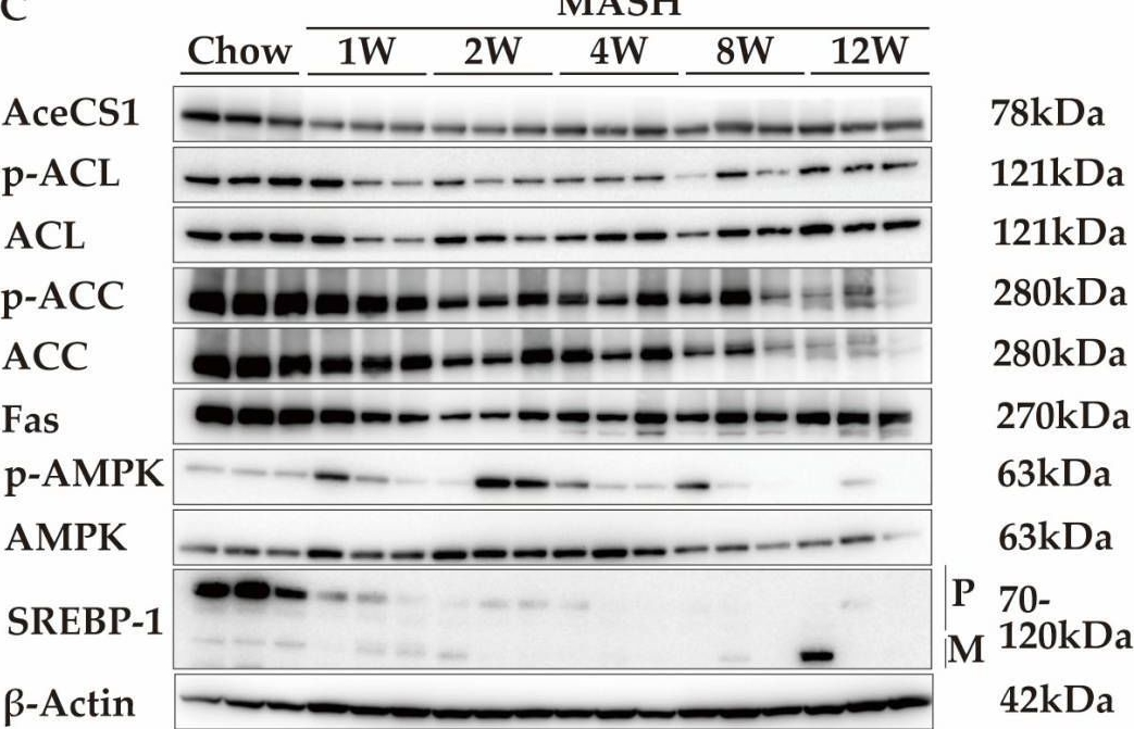 Fig.5.L showing Western Blotting in a Mus musculus (House mouse) sample from the publication: Novel Choline-Deficient and 0.1%-Methionine-Added High-Fat Diet Induces Burned-Out Metabolic-Dysfunction-Associated Steatohepatitis with Inflammation by Rapid Immune Cell Infiltration on Male Mice.
