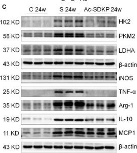 Fig.7.C showing Western Blotting from the publication: Glycolytic Reprogramming in Silica-Induced Lung Macrophages and Silicosis Reversed by Ac-SDKP Treatment.