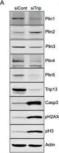 Fig.5.A showing Western Blotting in a Homo sapiens (Human) sample from the publication: Trip13 Depletion in Liver Cancer Induces a Lipogenic Response Contributing to Plin2-Dependent Mitotic Cell Death.