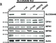 Fig.5.A showing Western Blotting in a Homo sapiens (Human) sample from the publication: The role of the mitochondrial outer membrane protein SLC25A46 in mitochondrial fission and fusion.