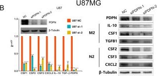 Fig.7.B showing Western Blotting from the publication: PDPN contributes to constructing immunosuppressive microenvironment in IDH wildtype glioma.