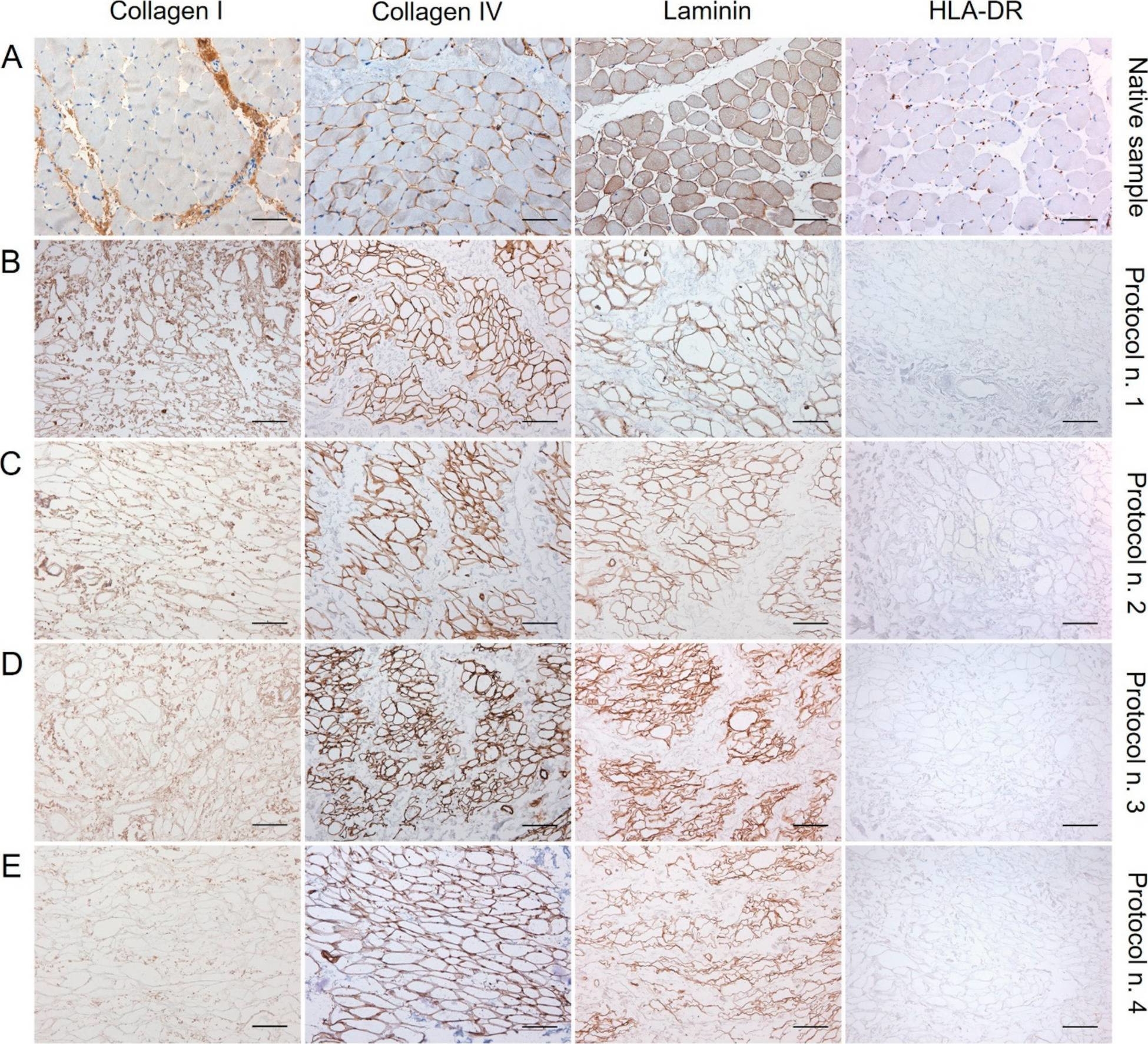 Fig.3.A showing Immunohistochemistry from the publication: Preclinical Development of Bioengineered Allografts Derived from Decellularized Human Diaphragm.