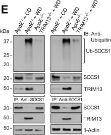 Fig.5.E showing Western Blotting from the publication: TRIM13 reduces cholesterol efflux and increases oxidized LDL uptake leading to foam cell formation and atherosclerosis.
