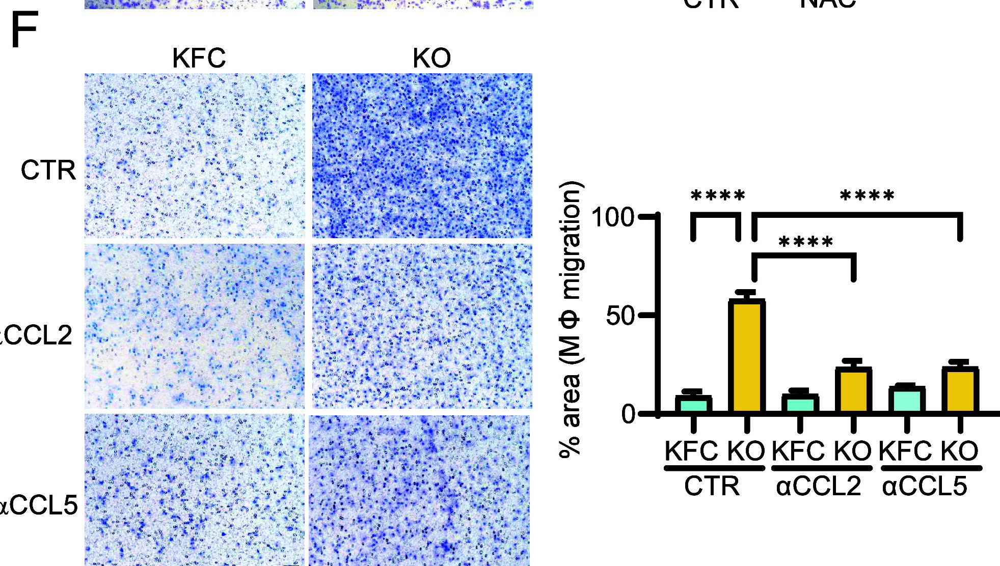 Fig.4.F showing Immunohistochemistry from the publication: Regulation of ROS signaling by TIGAR induces cancer-modulating responses in the tumor microenvironment.