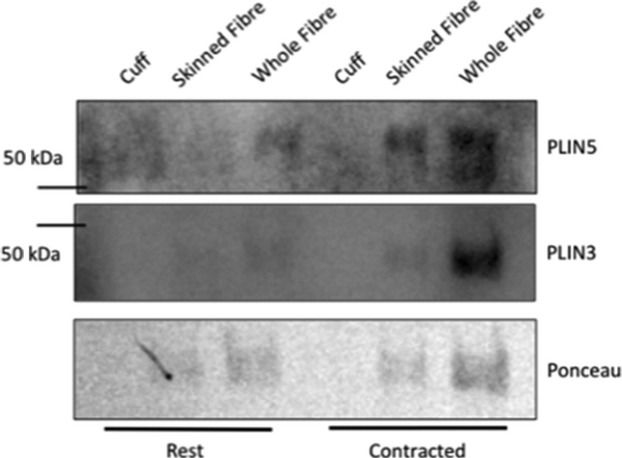 Higher PLIN5 but not PLIN3 content in isolated skeletal muscle mitochondria following acute in vivo contraction in rat hindlimb.