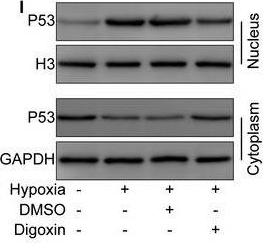 Fig.1.I showing Western Blotting in a Mus musculus (House mouse) sample from the publication: The HIF-1α/p53/miRNA-34a/Klotho axis in retinal pigment epithelial cells promotes subretinal fibrosis and exacerbates choroidal neovascularization.