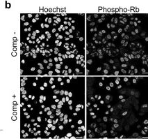 Fig.2.B showing Immunocytochemistry-immunofluorescence in a Homo sapiens (Human) sample from the publication: Compressive stress inhibits proliferation in AsPC-1 pancreatic cancer cells and reduction of Myc protein.