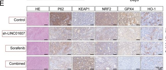 Fig.6.E showing Immunohistochemistry from the publication: LINC01607 promotes hepatocellular carcinoma progression and ferroptosis-associated therapy resistance with functional involvement of the p62-Keap1-Nrf2 pathway.