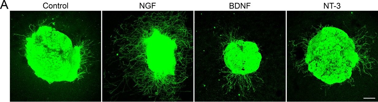 Fig.5.A showing Immunohistochemistry-immunofluorescence from the publication: Neuron-specific RNA-sequencing reveals different responses in peripheral neurons after nerve injury.