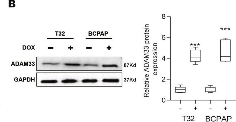 Fig.1.B showing Western Blotting in a Homo sapiens (Human) sample from the publication: Role of ADAM33 short isoform as a tumor suppressor in the pathogenesis of thyroid cancer via oncogenic function disruption of full-length ADAM33.