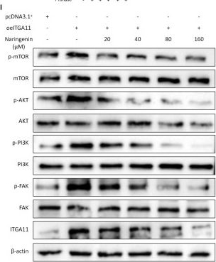 Fig.7.I showing Western Blotting from the publication: Naringenin, a Food-Derived Flavanone, Suppresses ITGA11-Associated Gastric Cancer Progression via the FAK/PI3K/AKT/mTOR Axis.