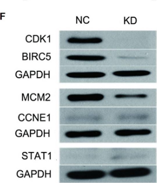 Fig.5.F showing Western Blotting in a Homo sapiens (Human) sample from the publication: FAM83D acts as an oncogene by regulating cell cycle progression via multiple pathways in synovial sarcoma: a potential novel downstream target oncogene of anlotinib.