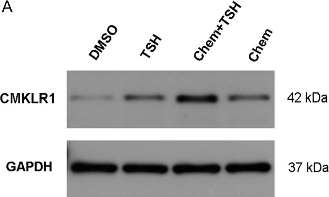Fig.2.A showing Western Blotting in a Rattus norvegicus (Rat) sample from the publication: TSH promotes chemerin/CMKLR1-cAMP/ERK-DIO2 signaling in primary rat ependymal cells in vitro.