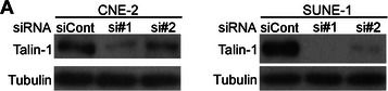 Fig.5.A showing Western Blotting from the publication: High expression of Talin-1 is associated with poor prognosis in patients with nasopharyngeal carcinoma.