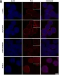 Fig.2.B showing Immunohistochemistry-immunofluorescence in a Homo sapiens (Human) sample from the publication: Improved contractile potential in detrusor microtissues from pediatric patients with end stage lower urinary tract dysfunction.