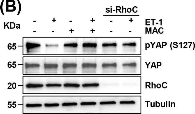 Fig.1.B showing Western Blotting in a Homo sapiens (Human) sample from the publication: YAP signaling orchestrates the endothelin-1-guided invadopodia formation in high-grade serous ovarian cancer.