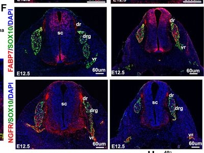 Fig.1.F showing Immunohistochemistry-immunofluorescence in a Mus musculus (House mouse) sample from the publication: Etv5 Is Required for Peripheral Nerve Function and the Injury Response.