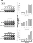 Fig.6.B showing Western Blotting from the publication: Deoxyshikonin Mediates Heme Oxygenase-1 Induction and Apoptotic Response via p38 Signaling in Tongue Cancer Cell Lines.