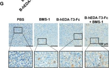 Fig.6.G showing Immunohistochemistry from the publication: Designing multifunctional recombinant vaccines: an engineering strategy based on innovative epitope prediction-guided splicing.