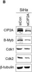 Fig.6.B showing Western Blotting from the publication: CIP2A facilitates the G1/S cell cycle transition via B-Myb in human papillomavirus 16 oncoprotein E6-expressing cells.