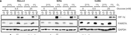 Fig.3.A showing Western Blotting from the publication: FAM57A (Family with Sequence Similarity 57 Member A) Is a Cell-Density-Regulated Protein and Promotes the Proliferation and Migration of Cervical Cancer Cells.