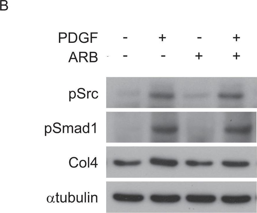 Activation of Src mediates PDGF-induced Smad1 phosphorylation and contributes to the progression of glomerulosclerosis in glomerulonephritis.