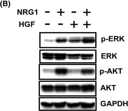 Fig.2.B showing Western Blotting from the publication: Dual-targeting therapy against HER3/MET in human colorectal cancers.