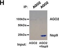 Fig.2.H showing Western Blotting from the publication: SARS-CoV-2 RNA-binding protein suppresses extracellular miRNA release.