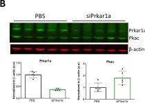 Fig.1.B showing Western Blotting from the publication: Activation of Protein Kinase A (PKA) signaling mitigates congenital hyperinsulinism associated hypoglycemia in the Sur1-/- mouse model.