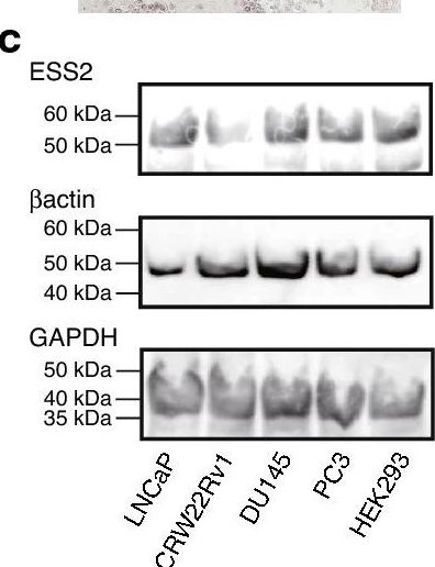 Fig.1.C showing Western Blotting from the publication: ESS2 controls prostate cancer progression through recruitment of chromodomain helicase DNA binding protein 1.