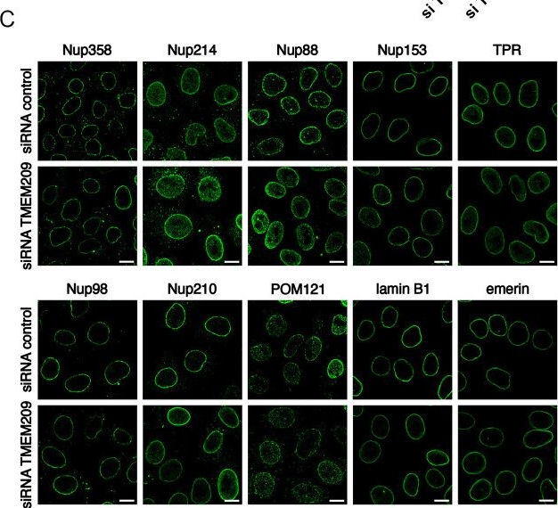 Fig.5.C showing Immunocytochemistry-immunofluorescence from the publication: The nuclear envelope protein TMEM209 is an integral component of the nuclear pore complex and interacts with Nup210.