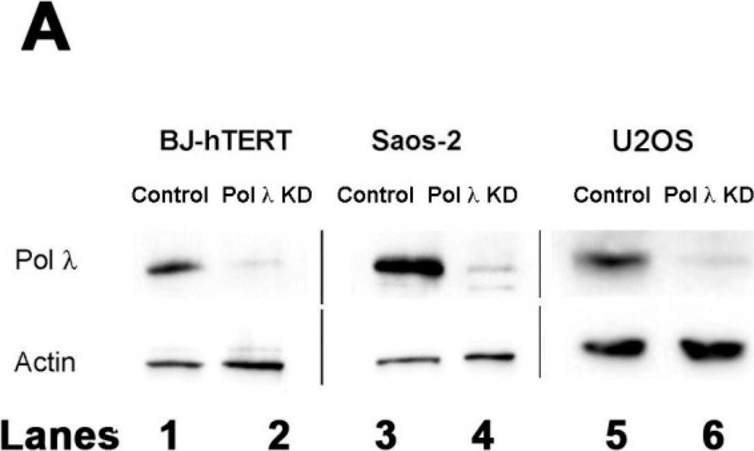 Fig.1.A showing Western Blotting in a Homo sapiens (Human) sample from the publication: A Role for Human DNA Polymerase λ in Alternative Lengthening of Telomeres.