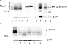 Fig.2.B showing Western Blotting in a Mus musculus (House mouse) sample from the publication: The Transcription Factor NFATc1 Supports the Rejection of Heterotopic Heart Allografts.