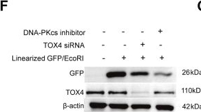 Fig.3.F showing Western Blotting from the publication: TOX High-Mobility Group Box Family Member 4 promotes DNA double-strand break repair via nonhomologous end joining.