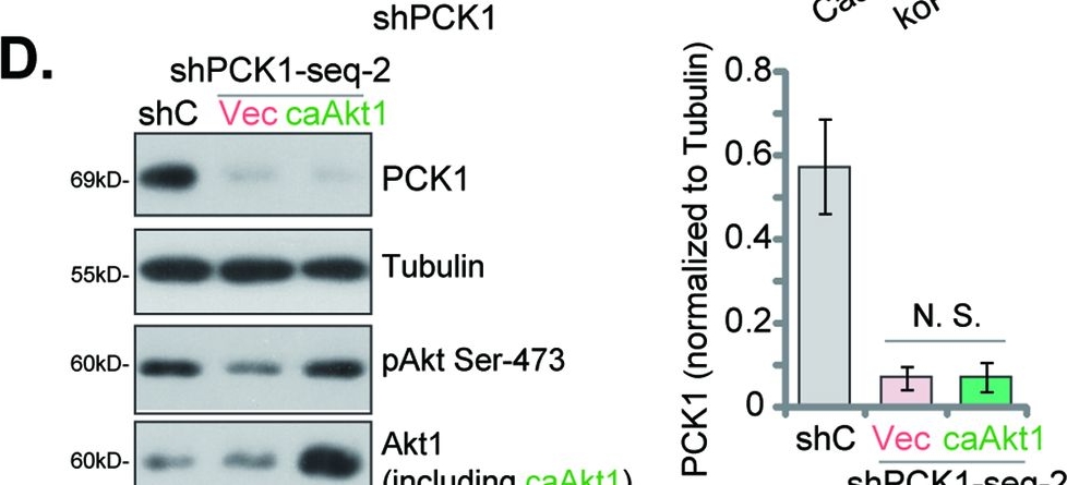 Fig.6.D showing Western Blotting from the publication: Expression and functional significance of phosphoenolpyruvate carboxykinase 1 in uveal melanoma.