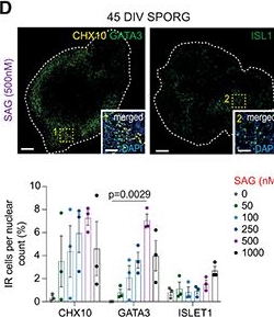 Fig.1.D showing Immunohistochemistry-immunofluorescence from the publication: A human corticospinal organoid-slice connectoid model informs enhancer strategies for post-injury axon regrowth.