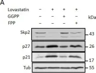 Fig.3.A showing Western Blotting in a Homo sapiens (Human) sample from the publication: Statin-induced depletion of geranylgeranyl pyrophosphate inhibits cell proliferation by a novel pathway of Skp2 degradation.