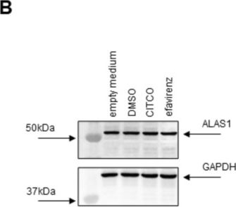 Fig.3.B showing Western Blotting in a Homo sapiens (Human) sample from the publication: Impact of Efavirenz on Heme Protein Induction and Biomarkers: Insights From In&nbsp;Vitro Experiments and a Clinical Study.