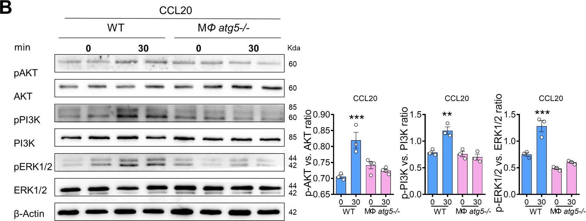 Fig.8.B showing Western Blotting from the publication: Atg5 deficiency in macrophages protects against kidney fibrosis via the CCR6-CCL20 axis.