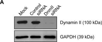 Fig.2.A showing Western Blotting from the publication: Impact of dynasore an inhibitor of dynamin II on Shigella flexneri infection.