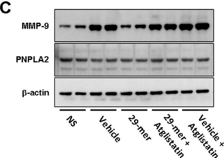 Fig.3.C showing Western Blotting from the publication: The Therapeutic Effects of a PEDF-Derived Short Peptide on Murine Experimental Dry Eye Involves Suppression of MMP-9 and Inflammation.