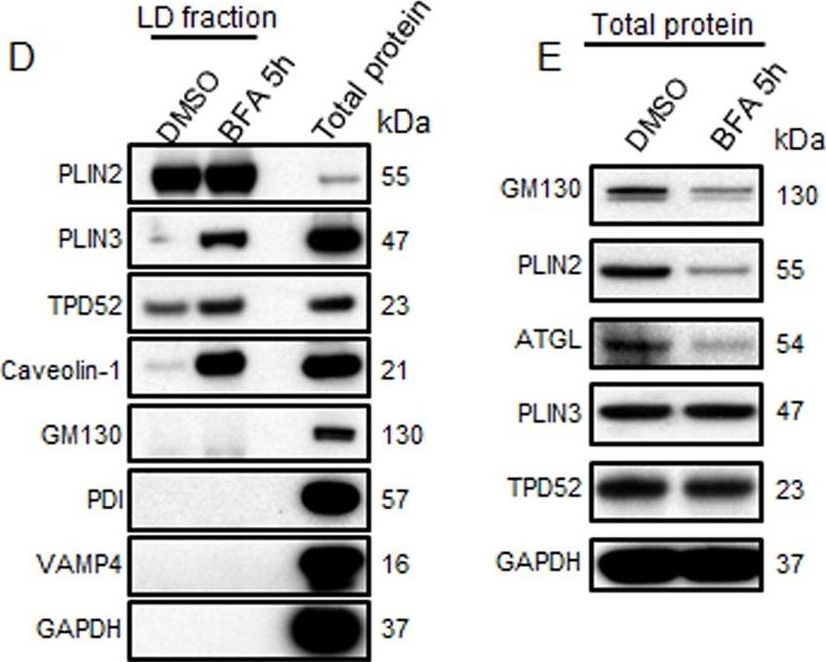 Delayed recruiting of TPD52 to lipid droplets - evidence for a "second wave" of lipid droplet-associated proteins that respond to altered lipid storage induced by Brefeldin A treatment.