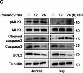 Fig.5.C showing Western Blotting in a Homo sapiens (Human) sample from the publication: Inducible CD147 up-regulation boosts extended SARS-CoV-2 infection triggering severe COVID-19 independent of ACE2.