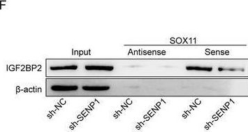 Fig.6.F showing Western Blotting from the publication: DeSUMOylation of IGF2BP2 Promotes Neuronal Differentiation of OM-MSCs by Stabilizing SOX11 to Ameliorate Brain Injury After Intracerebral Hemorrhage.