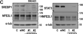 Fig.3.C showing Western Blotting from the publication: Mitochondrial Respiratory Defect Enhances Hepatoma Cell Invasiveness via STAT3/NFE2L1/STX12 Axis.