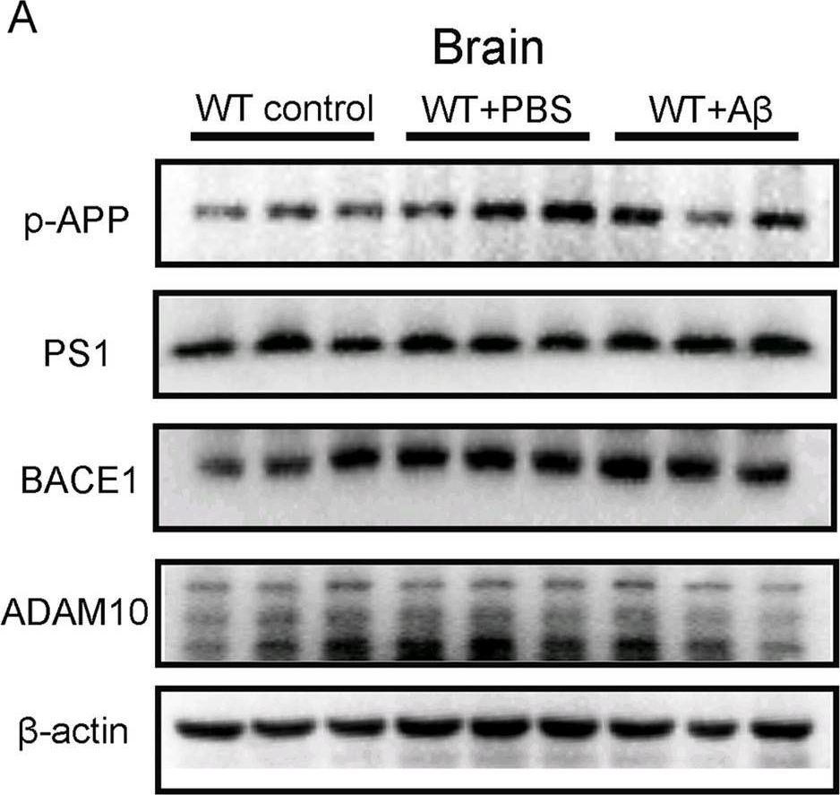Fig.7.A showing Western Blotting from the publication: Injection of amyloid-β to lateral ventricle induces gut microbiota dysbiosis in association with inhibition of cholinergic anti-inflammatory pathways in Alzheimer's disease.
